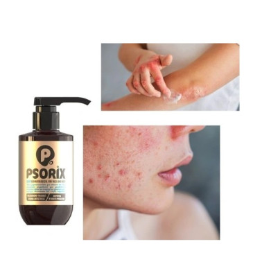 PSORIX: Dermatologické mýdlo na obličej a tělo, Psoria - Lupenka 300ml